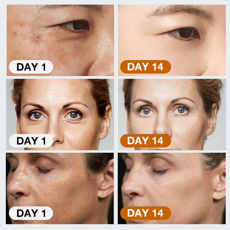 Buy 1 get 3 free - Upgrade Ellen Ella Retinol Face Cream - Effect increased by 50% - Help reveal smoother, firmer-looking skin with this gentle retinol treatment