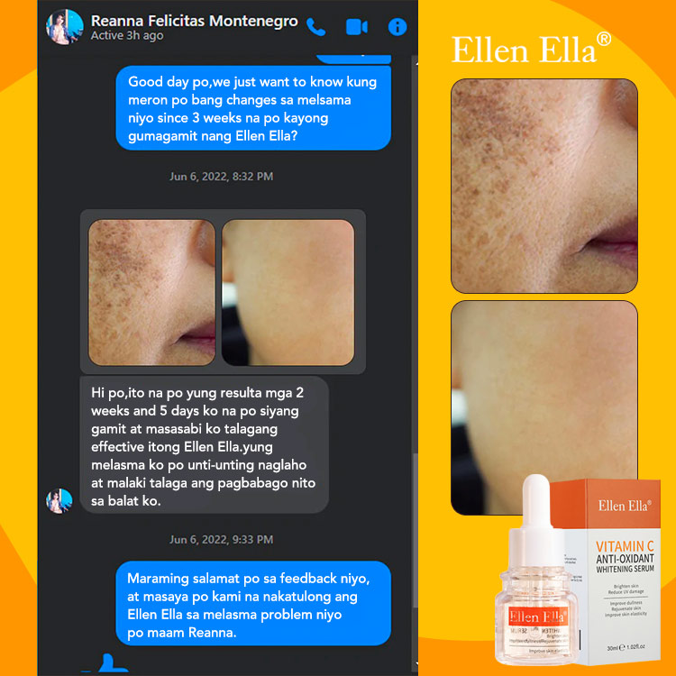 Ellen Ella Whitening Glow Serum buy one take one - Get Brighter Skin in 4 Weeks - Fades freckles, melasma and sun spots 
