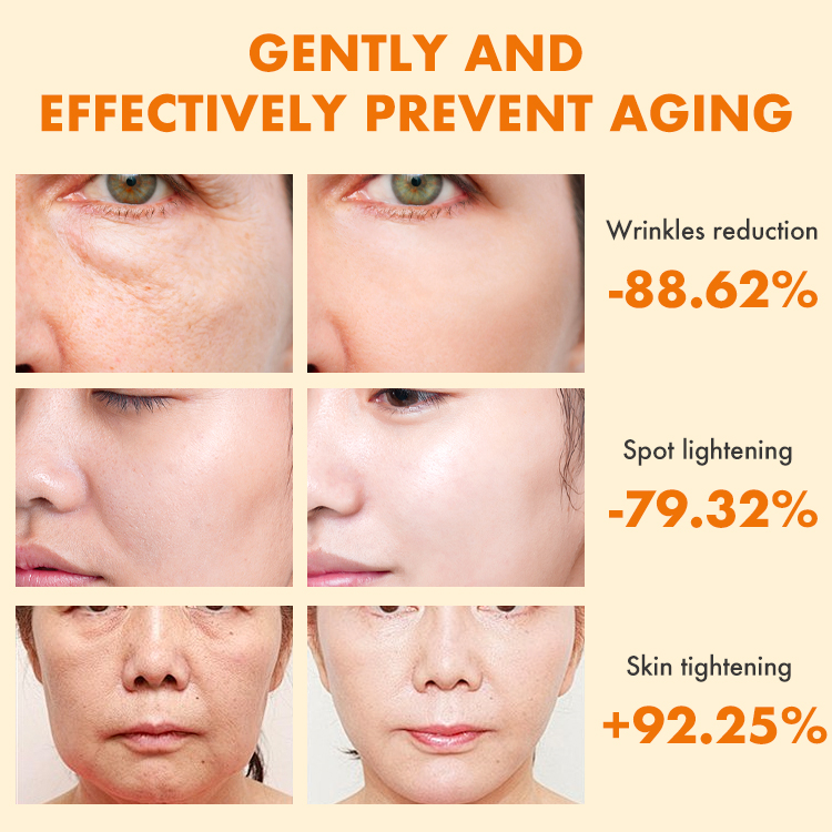 Ellen Ella Upgraded 4X Retinol Serum - Added 24K Gold Foil - 4 in 1 The Strongest Repairing Anti-Aging Serum