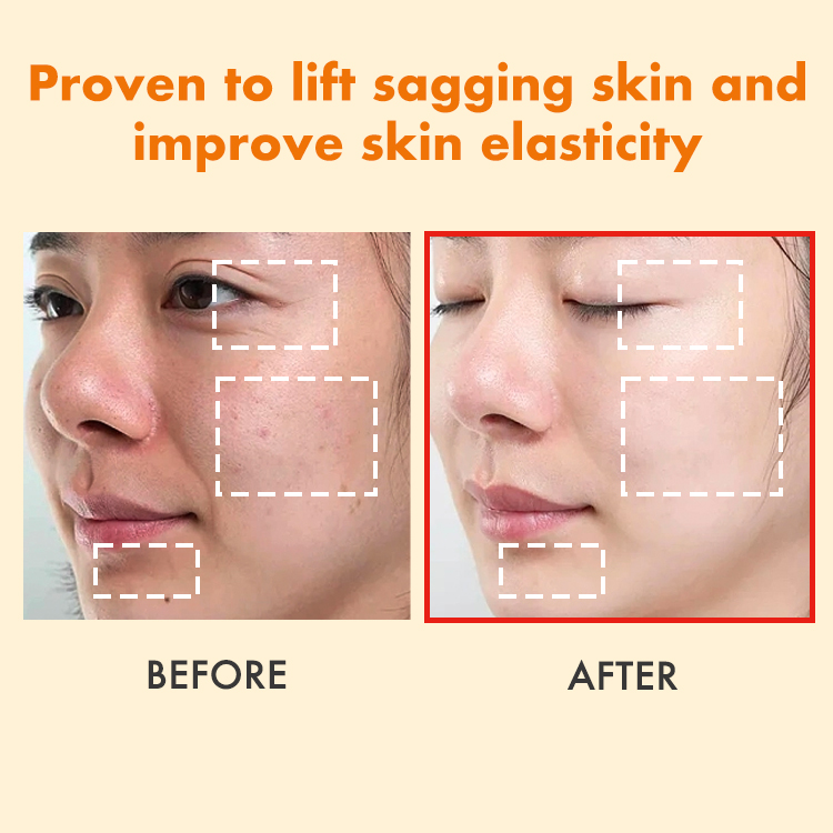 Ellen Ella Upgraded 4X Retinol Serum - Added 24K Gold Foil - 4 in 1 The Strongest Repairing Anti-Aging Serum